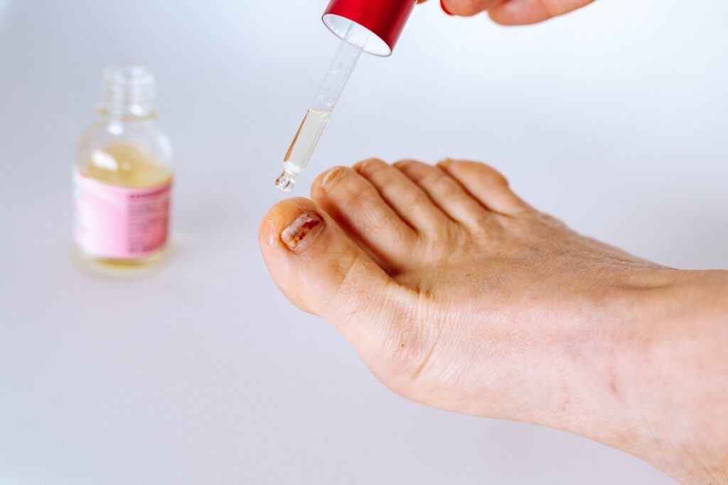 Une personne qui verse de l'huile essentielle sur l'ongle