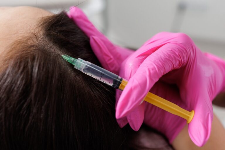 Une femme qui reçoit une injection de cuir chevelu
